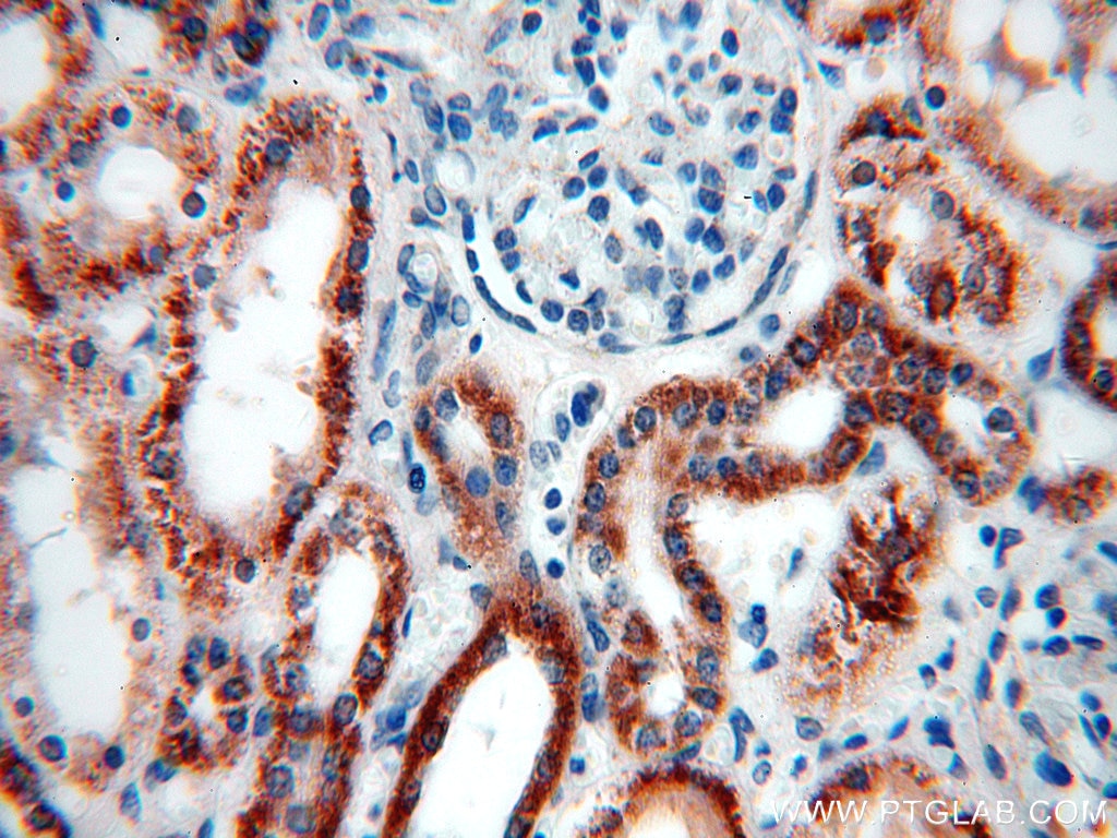 Immunohistochemistry (IHC) staining of human kidney tissue using ACADS Polyclonal antibody (16623-1-AP)