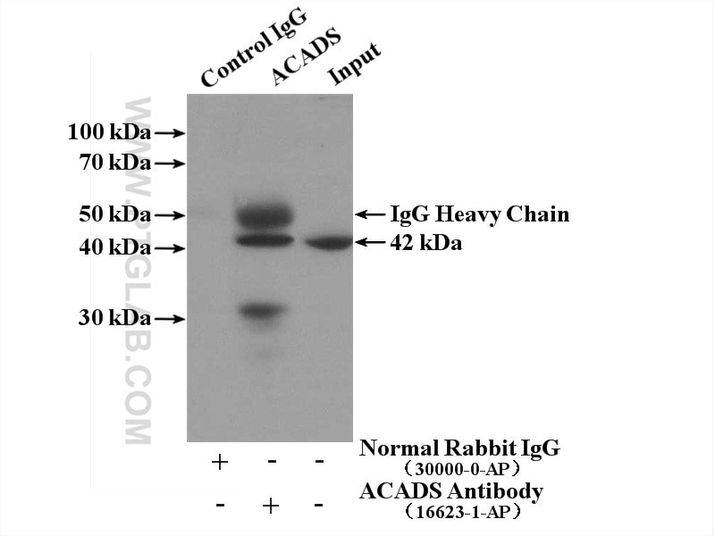 Immunoprecipitation (IP) experiment of HEK-293 cells using ACADS Polyclonal antibody (16623-1-AP)