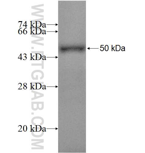 ACADS fusion protein Ag9922 SDS-PAGE
