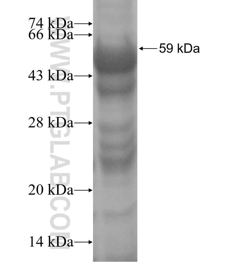 ACADSB fusion protein Ag3851 SDS-PAGE