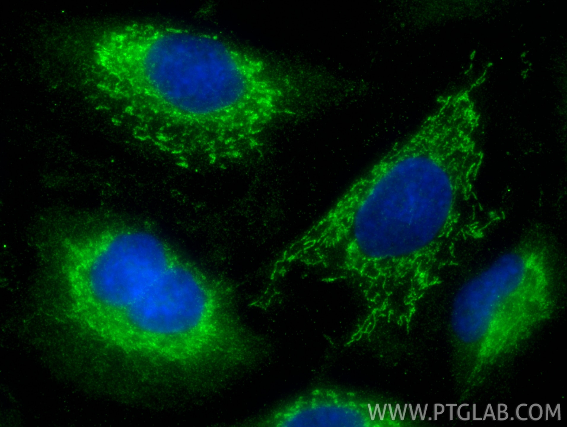 Immunofluorescent analysis of (-20°C Methanol) fixed A549 cells using ACADVL antibody (14527-1-AP) at dilution of 1:200 and CoraLite®488-Conjugated Goat Anti-Rabbit IgG(H+L) (SA00013-2). Immunofluorescence (IF) / fluorescent staining of A549 cells using ACADVL Polyclonal antibody (14527-1-AP)