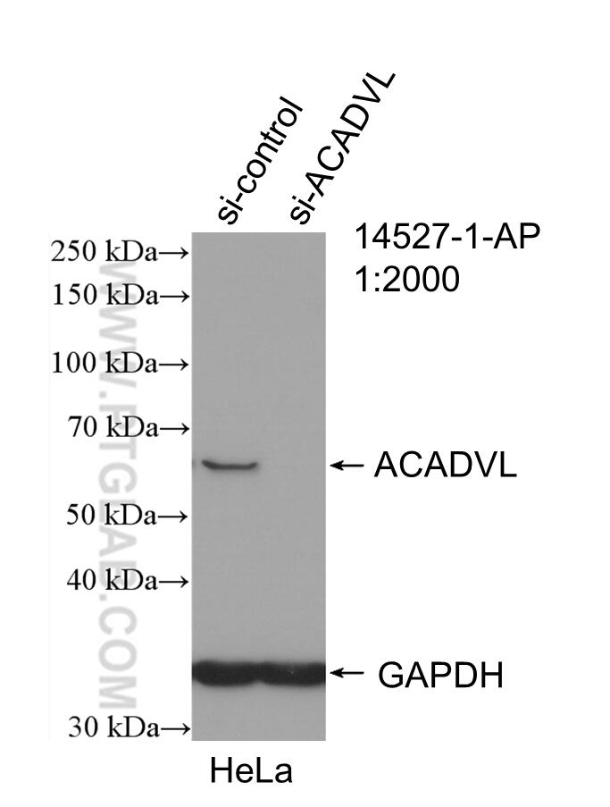 Western Blot (WB) analysis of HeLa cells using ACADVL Polyclonal antibody (14527-1-AP)