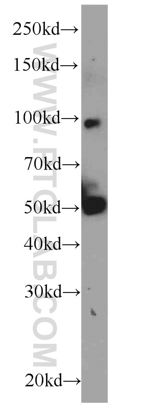 ACADVL Polyclonal antibody