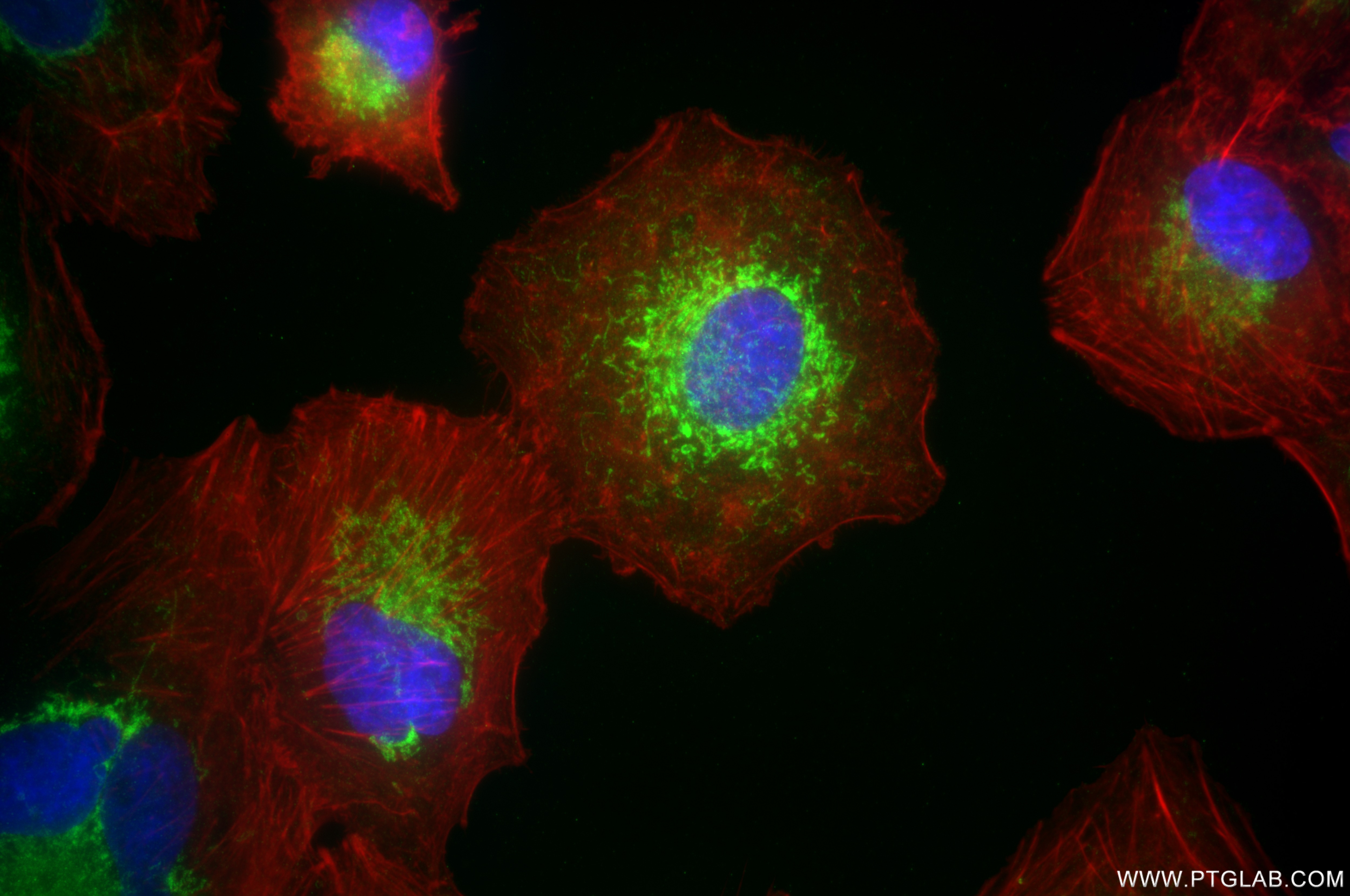 Immunofluorescence (IF) / fluorescent staining of A549 cells using ACADVL Recombinant antibody (85889-1-RR)