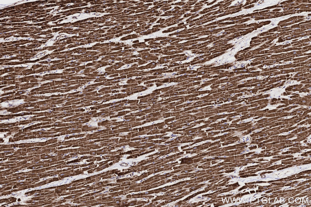 Immunohistochemistry (IHC) staining of human heart tissue using ACADVL Recombinant monoclonal antibody (85889-1-RR)