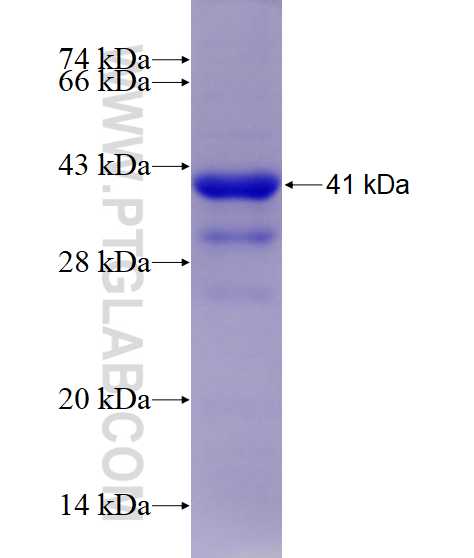 ACADVL fusion protein Ag6016 SDS-PAGE