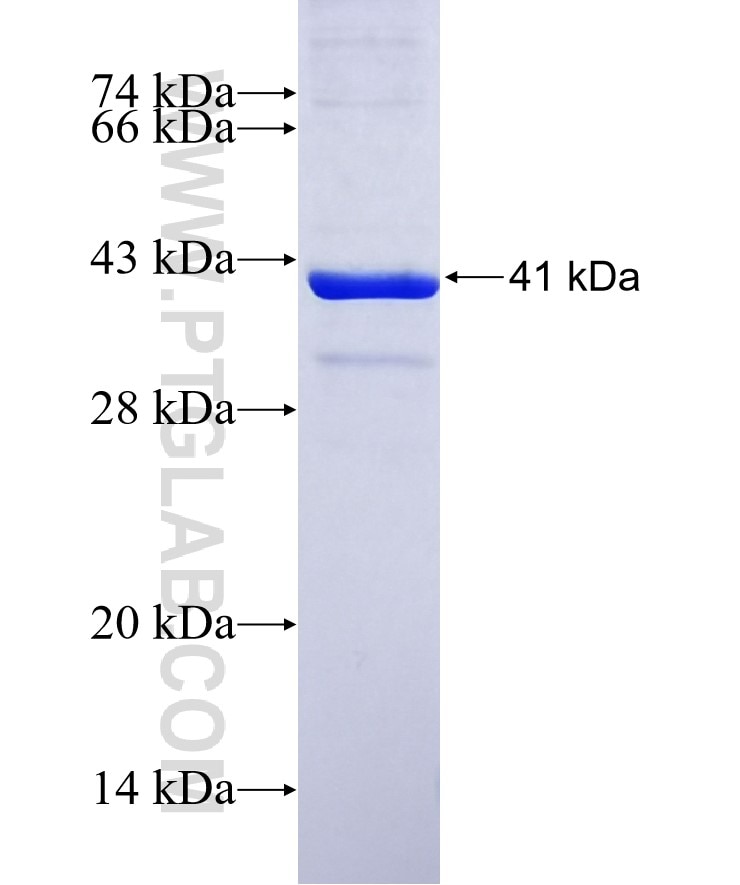 ACADVL fusion protein Ag6016 SDS-PAGE