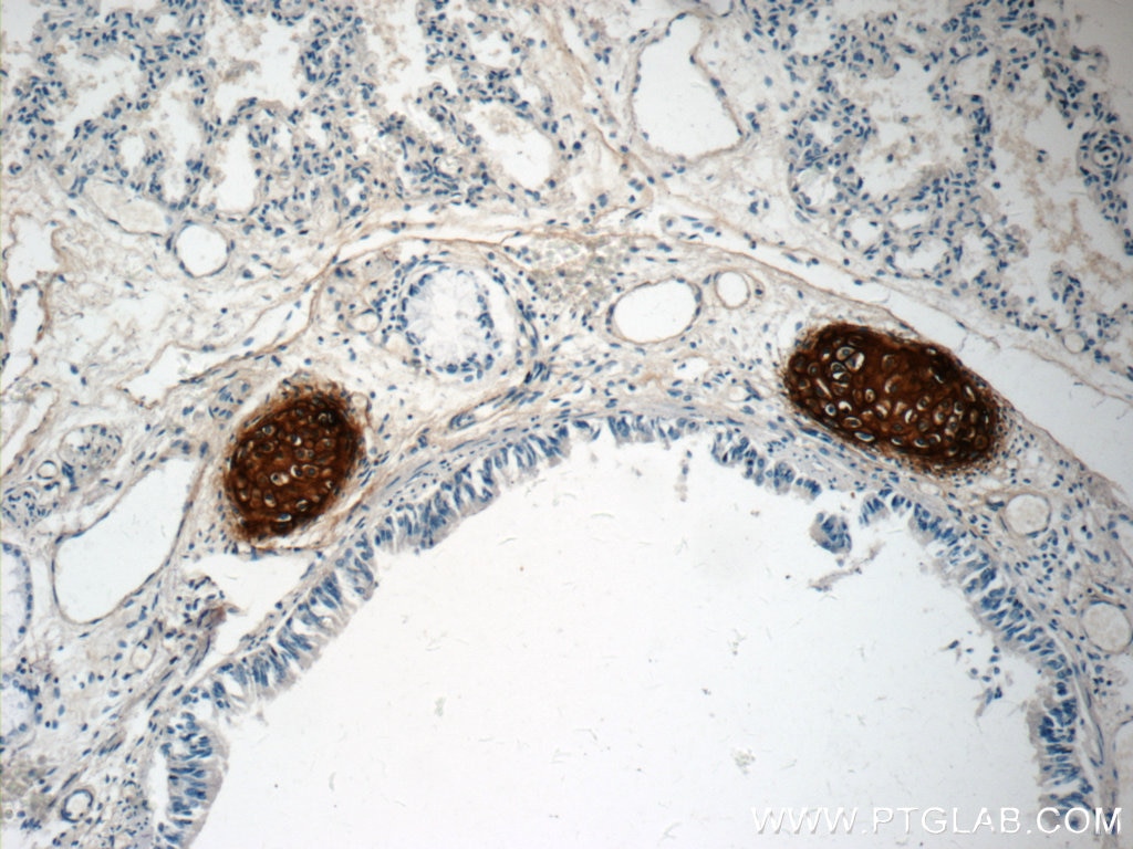 IHC staining of human lung using 13880-1-AP
