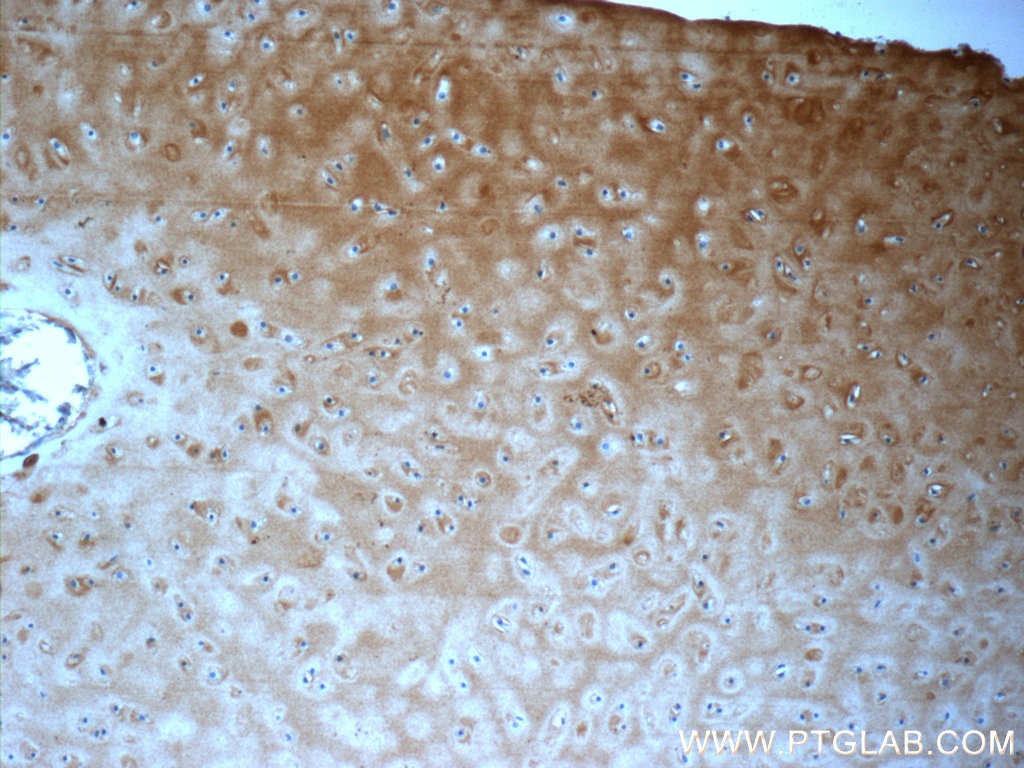 Immunohistochemistry (IHC) staining of human cartilage tissue using Aggrecan Polyclonal antibody (13880-1-AP)