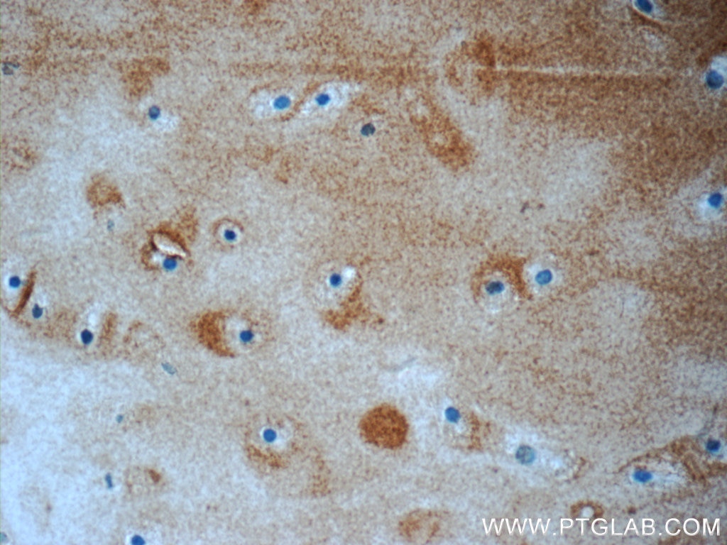 Immunohistochemistry (IHC) staining of human cartilage tissue using Aggrecan Polyclonal antibody (13880-1-AP)