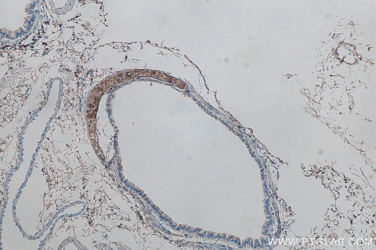 Immunohistochemistry (IHC) staining of mouse lung tissue using Aggrecan Polyclonal antibody (13880-1-AP)