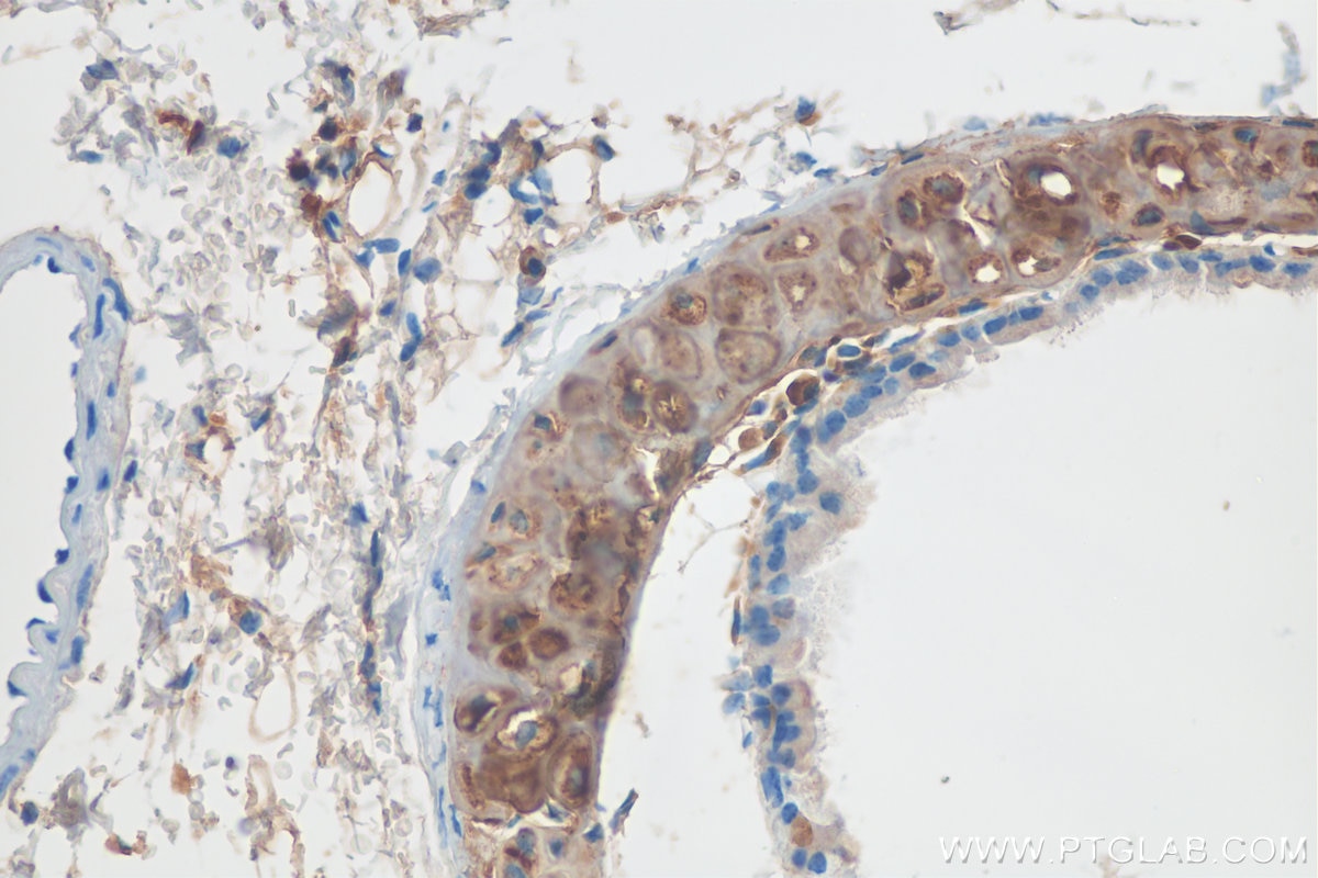 IHC staining of mouse lung using 13880-1-AP