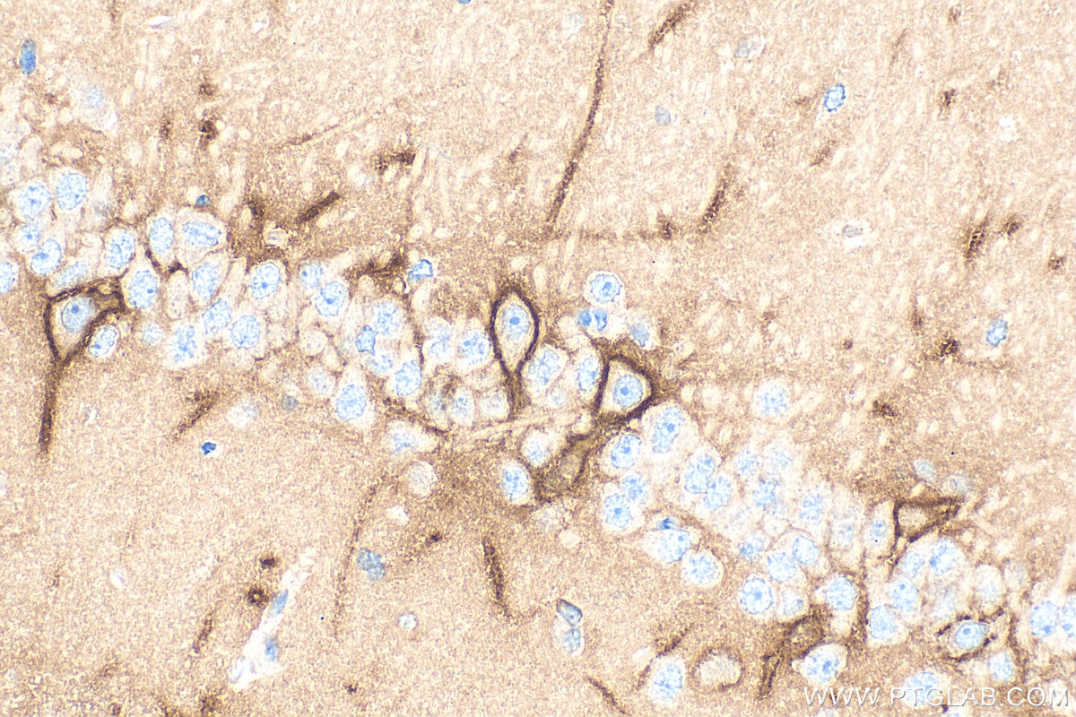 Immunohistochemistry (IHC) staining of rat brain tissue using Aggrecan Polyclonal antibody (13880-1-AP)
