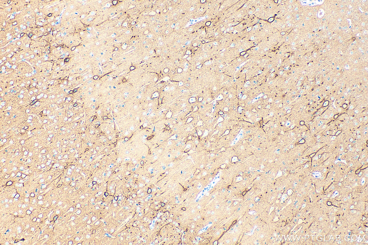 Immunohistochemistry (IHC) staining of rat brain tissue using Aggrecan Polyclonal antibody (13880-1-AP)