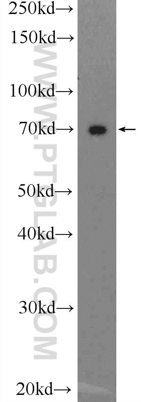 Aggrecan Polyclonal antibody