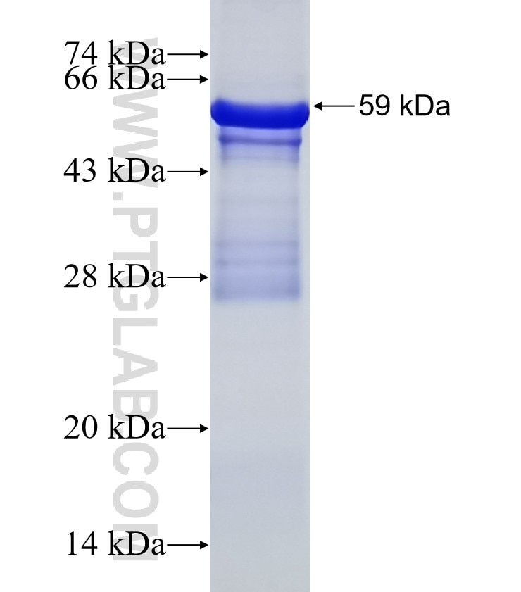 ACAN fusion protein Ag4985 SDS-PAGE