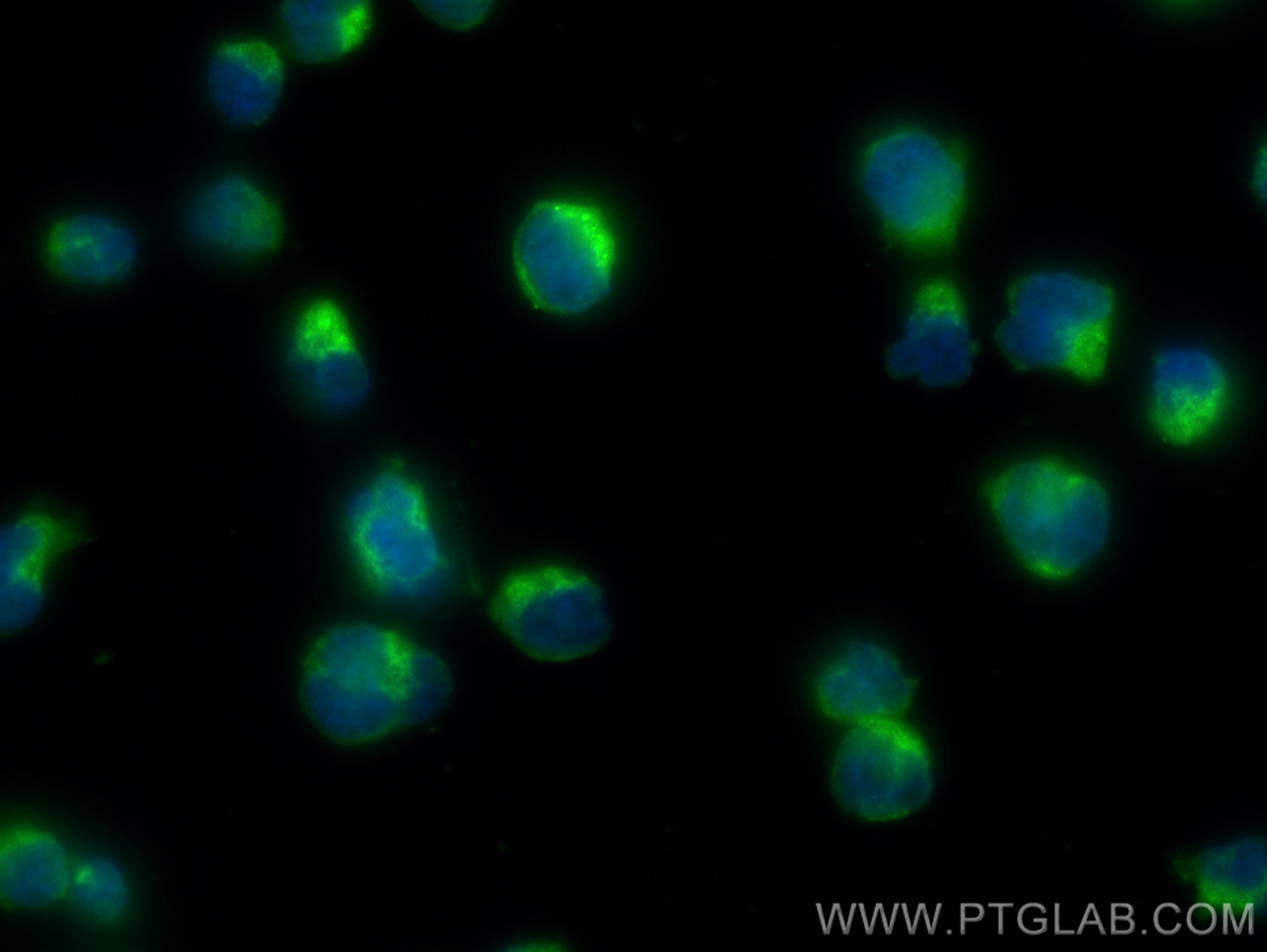 Immunofluorescence (IF) / fluorescent staining of Jurkat cells using ACAP1 Polyclonal antibody (20135-1-AP)