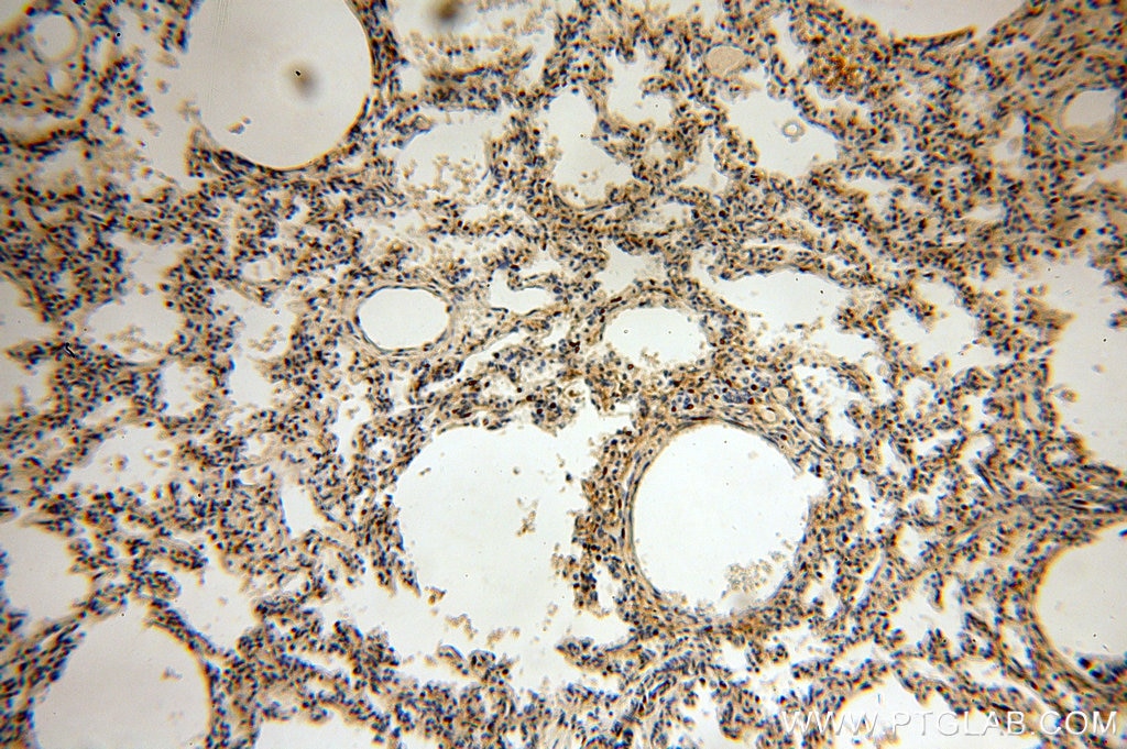 Immunohistochemistry (IHC) staining of human lung tissue using ACAP1 Polyclonal antibody (20135-1-AP)