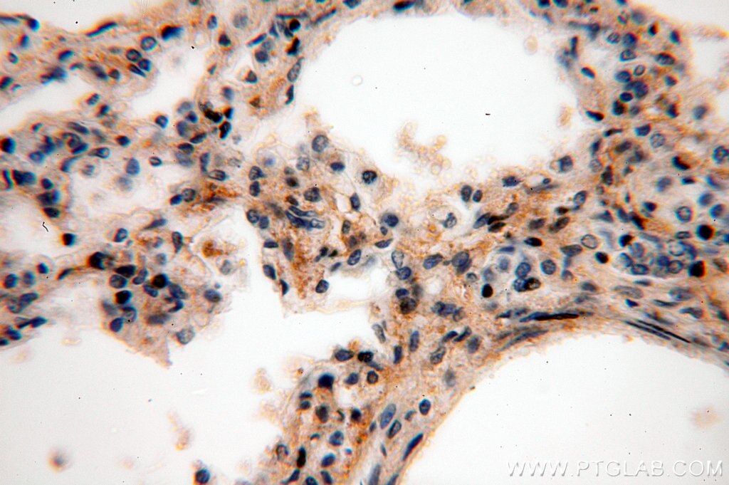 IHC staining of human lung using 20135-1-AP