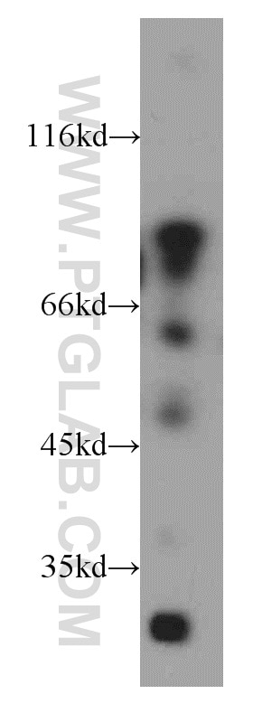 Western Blot (WB) analysis of Jurkat cells using ACAP1 Polyclonal antibody (20135-1-AP)