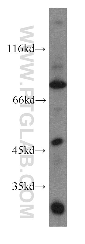 Western Blot (WB) analysis of Jurkat cells using ACAP1 Polyclonal antibody (20135-1-AP)