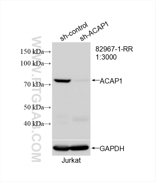 Western Blot (WB) analysis of Jurkat cells using ACAP1 Recombinant antibody (82967-1-RR)