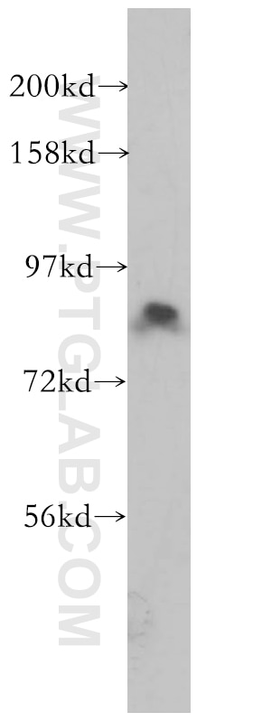 Western Blot (WB) analysis of Jurkat cells using ACAP2 Polyclonal antibody (14029-1-AP)