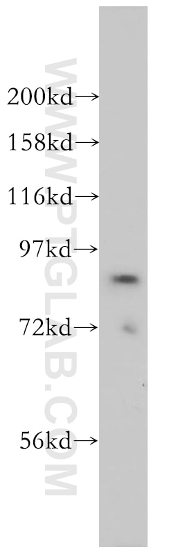 Western Blot (WB) analysis of NIH/3T3 cells using ACAP2 Polyclonal antibody (14029-1-AP)