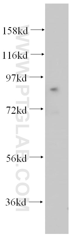 Western Blot (WB) analysis of Jurkat cells using ACAP2 Polyclonal antibody (14029-1-AP)