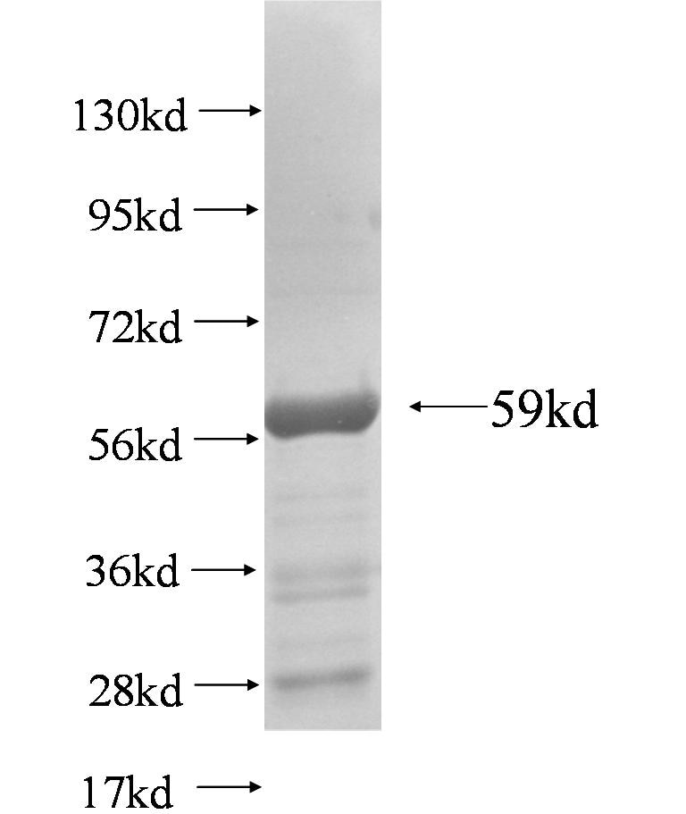 ACAP2 fusion protein Ag5190 SDS-PAGE