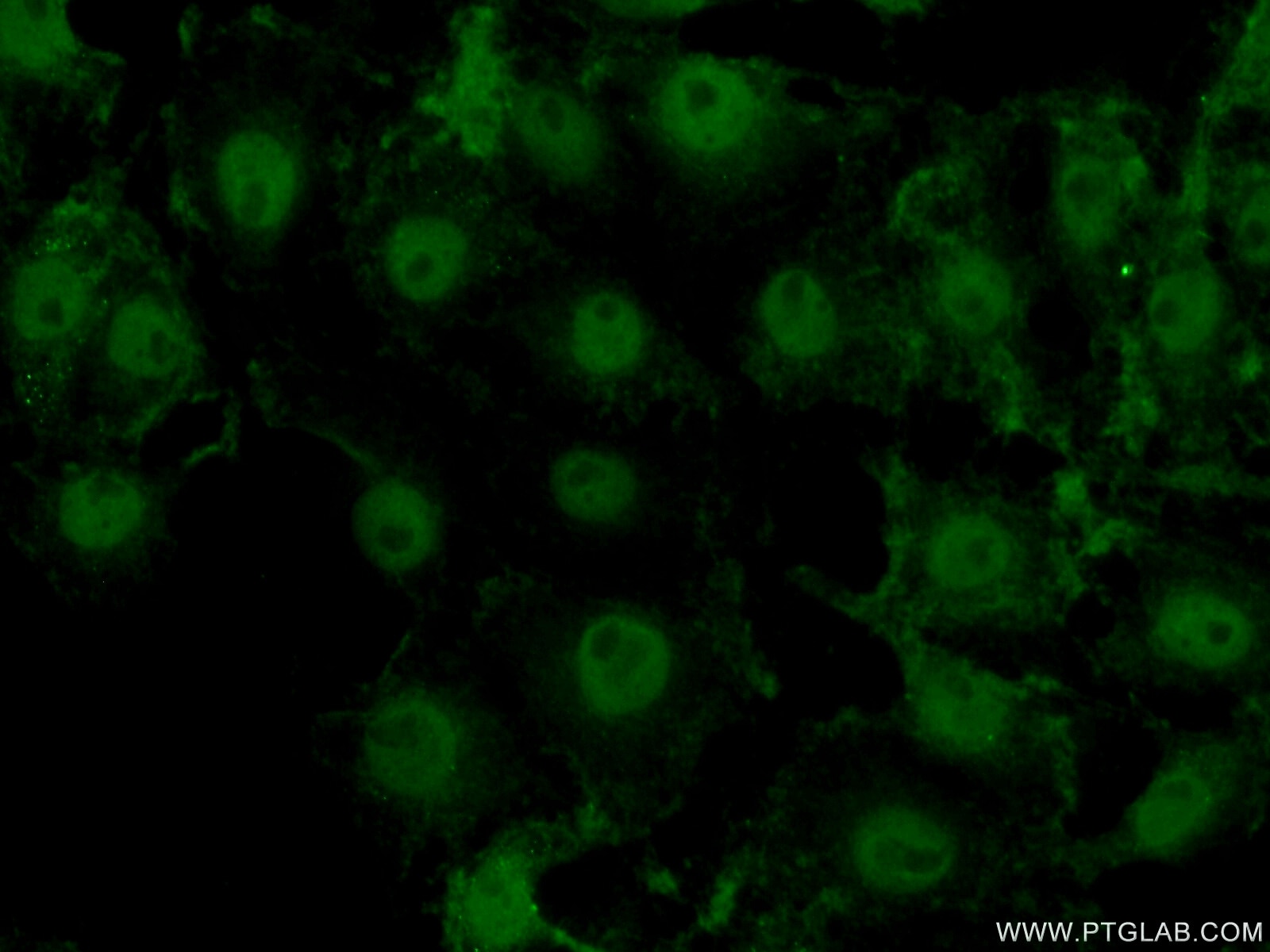 Immunofluorescence (IF) / fluorescent staining of SH-SY5Y cells using ACAP3 Polyclonal antibody (17570-1-AP)