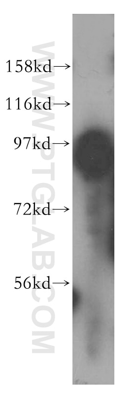 Western Blot (WB) analysis of SH-SY5Y cells using ACAP3 Polyclonal antibody (17570-1-AP)