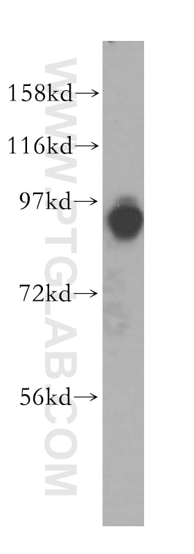Western Blot (WB) analysis of Jurkat cells using ACAP3 Polyclonal antibody (17570-1-AP)