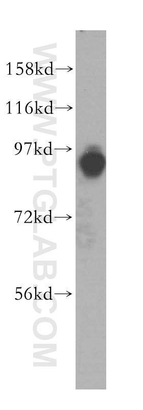 WB analysis of Jurkat using 17570-1-AP