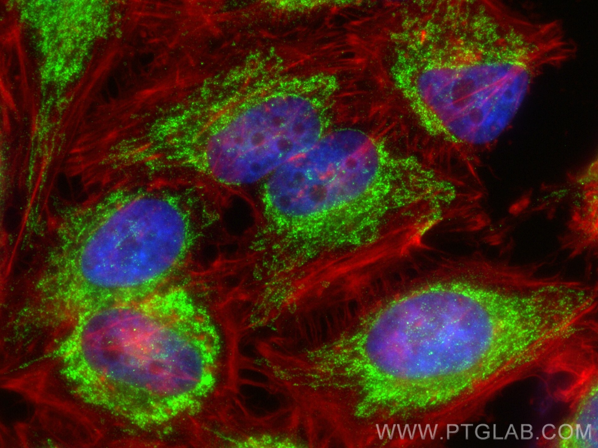 Immunofluorescence (IF) / fluorescent staining of HeLa cells using ACAT1 Polyclonal antibody (16215-1-AP)