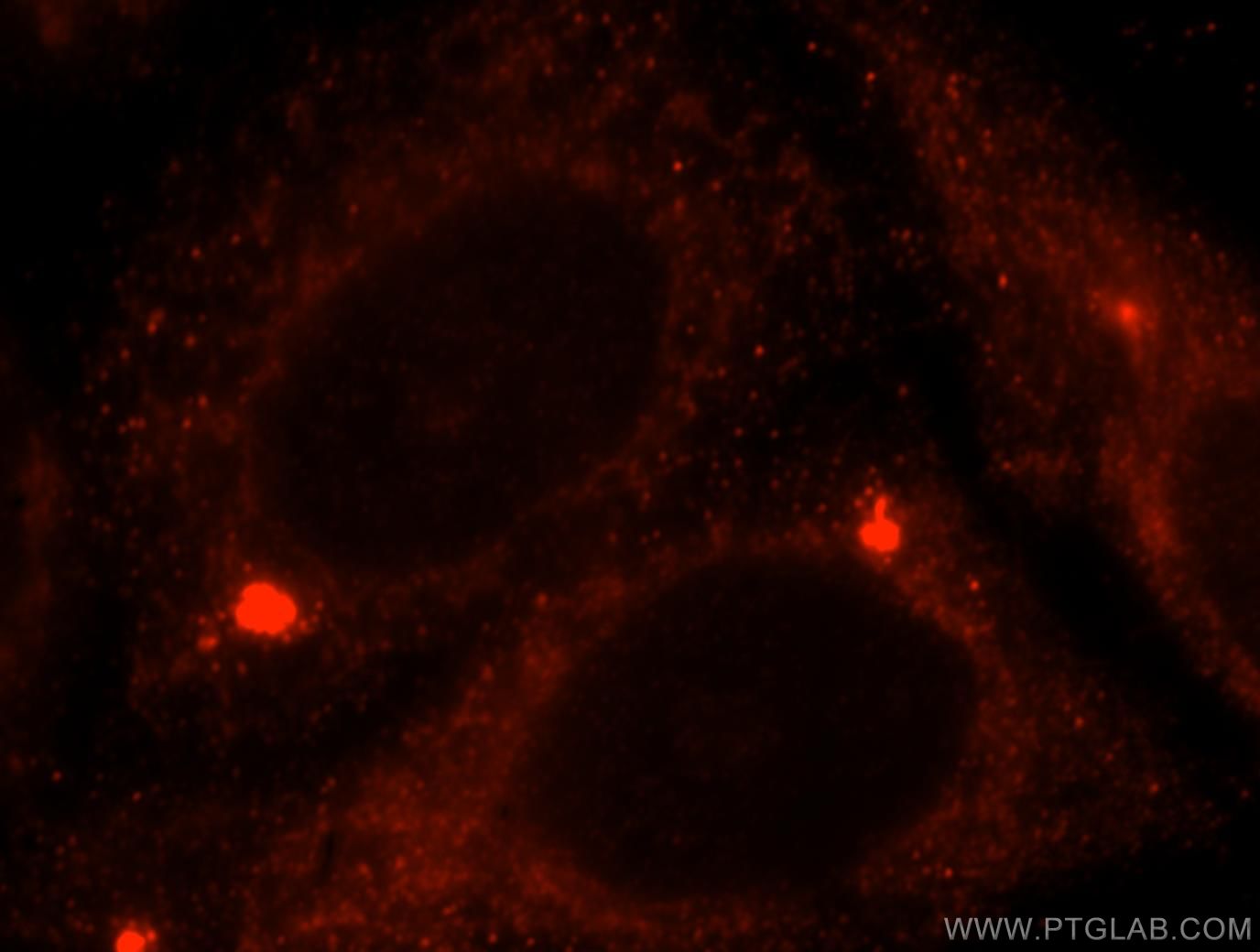 Immunofluorescence (IF) / fluorescent staining of HeLa cells using ACAT1 Polyclonal antibody (16215-1-AP)