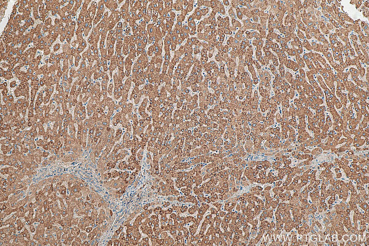 Immunohistochemistry (IHC) staining of human liver tissue using ACAT1 Polyclonal antibody (16215-1-AP)