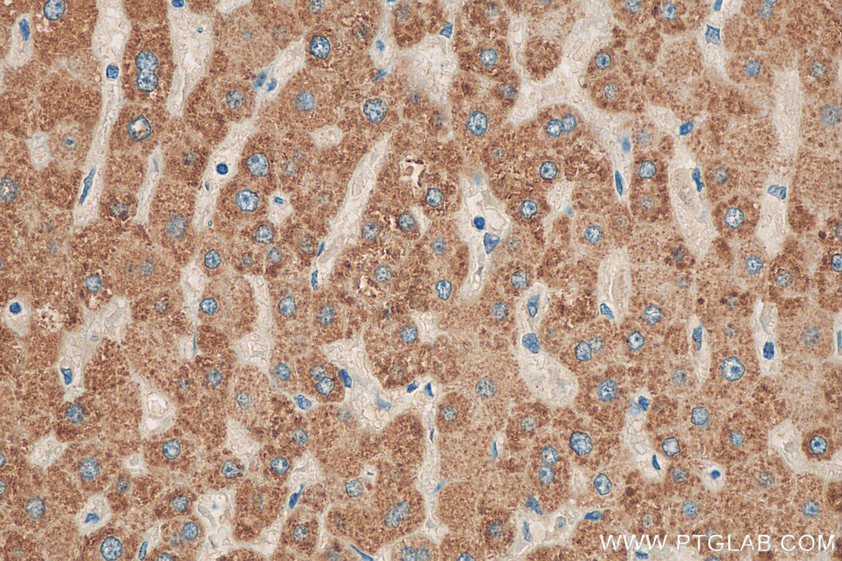 Immunohistochemistry (IHC) staining of human liver tissue using ACAT1 Polyclonal antibody (16215-1-AP)