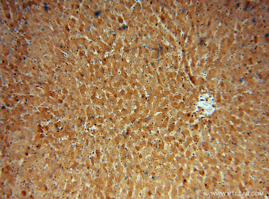 Immunohistochemistry (IHC) staining of human liver tissue using ACAT1 Polyclonal antibody (16215-1-AP)