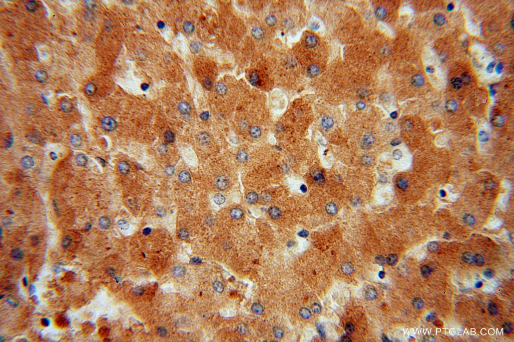 Immunohistochemistry (IHC) staining of human liver tissue using ACAT1 Polyclonal antibody (16215-1-AP)