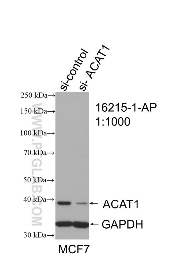 Western Blot (WB) analysis of MCF-7 cells using ACAT1 Polyclonal antibody (16215-1-AP)