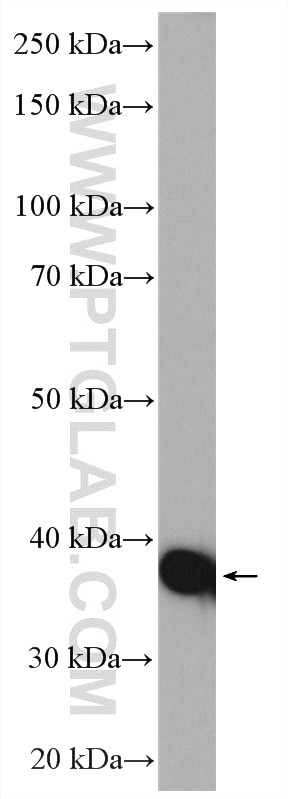 Western Blot (WB) analysis of mouse heart tissue using ACAT1 Polyclonal antibody (16215-1-AP)