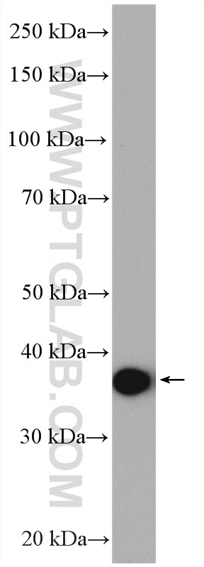Western Blot (WB) analysis of rat skeletal muscle tissue using ACAT1 Polyclonal antibody (16215-1-AP)