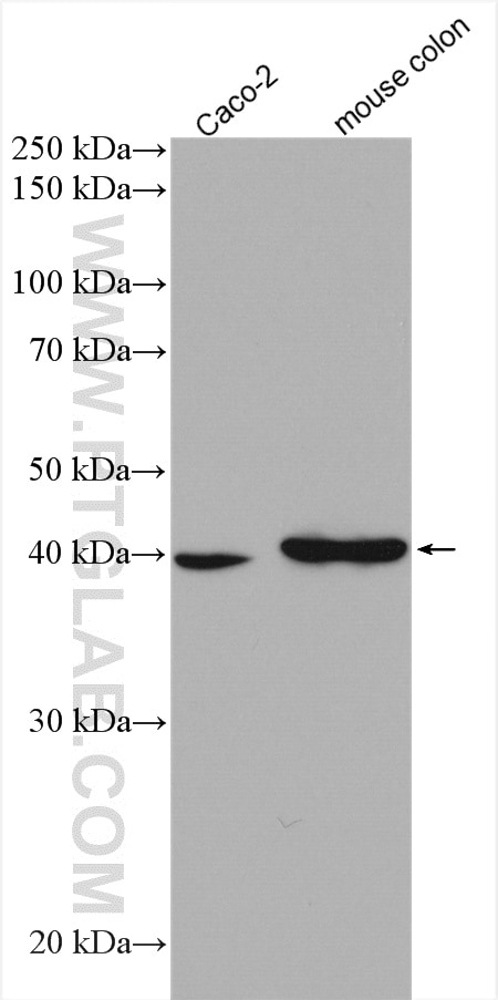 Western Blot (WB) analysis of various lysates using ACAT1 Polyclonal antibody (16215-1-AP)