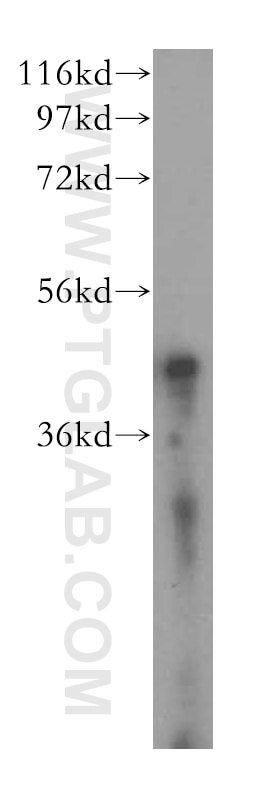 Western Blot (WB) analysis of human skeletal muscle tissue using ACAT1 Polyclonal antibody (16215-1-AP)