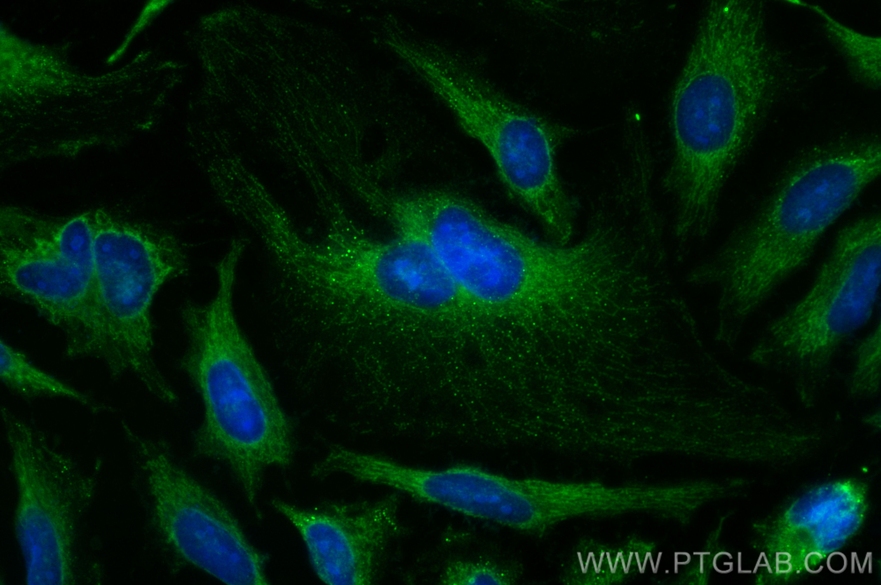 Immunofluorescence (IF) / fluorescent staining of HeLa cells using CoraLite® Plus 488-conjugated ACAT1 Polyclonal ant (CL488-16215)