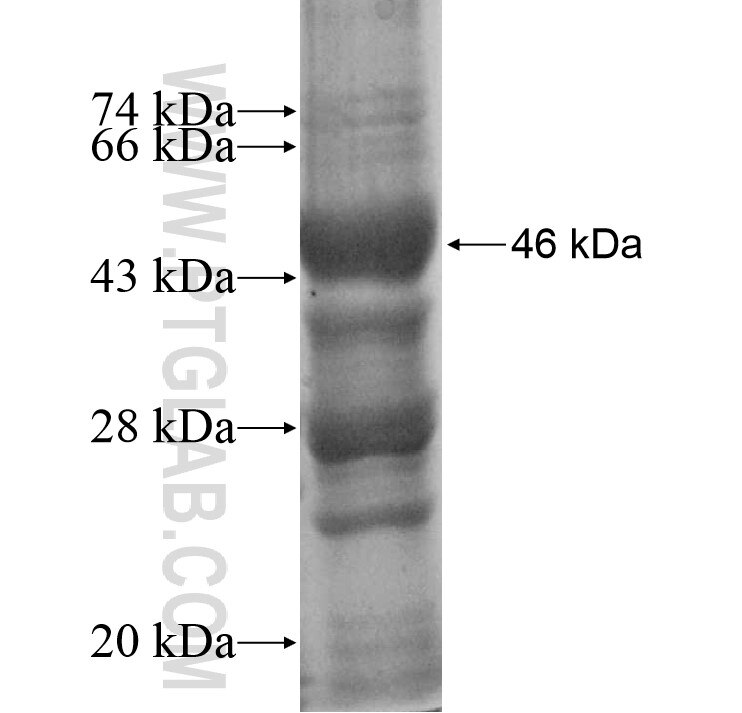 ACAT1 fusion protein Ag9215 SDS-PAGE