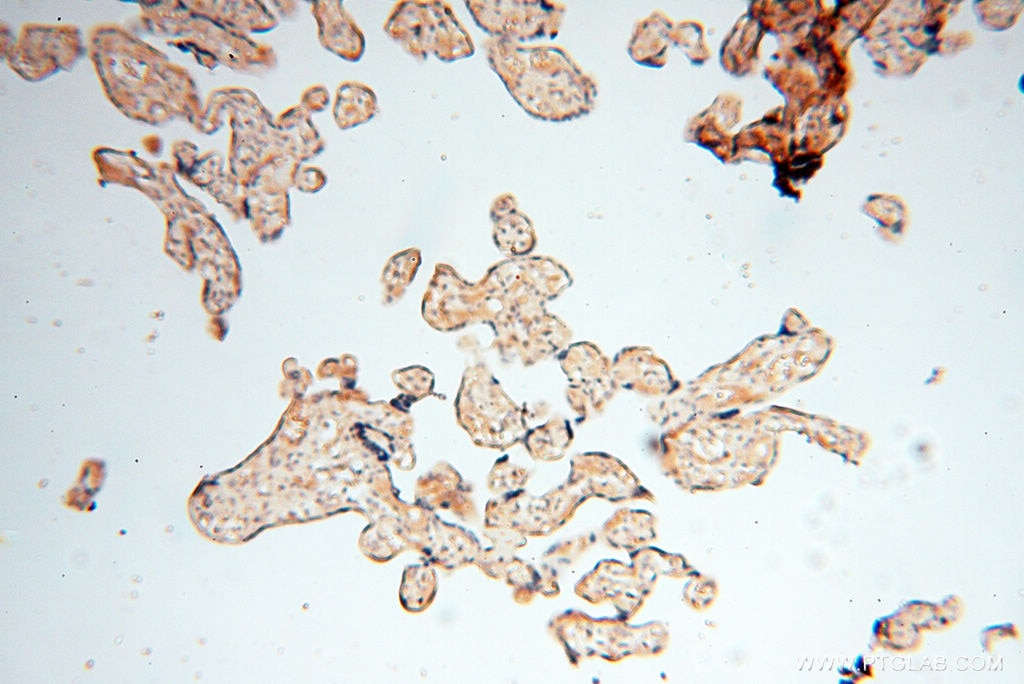 Immunohistochemistry (IHC) staining of human placenta tissue using ACAT2 Polyclonal antibody (14755-1-AP)