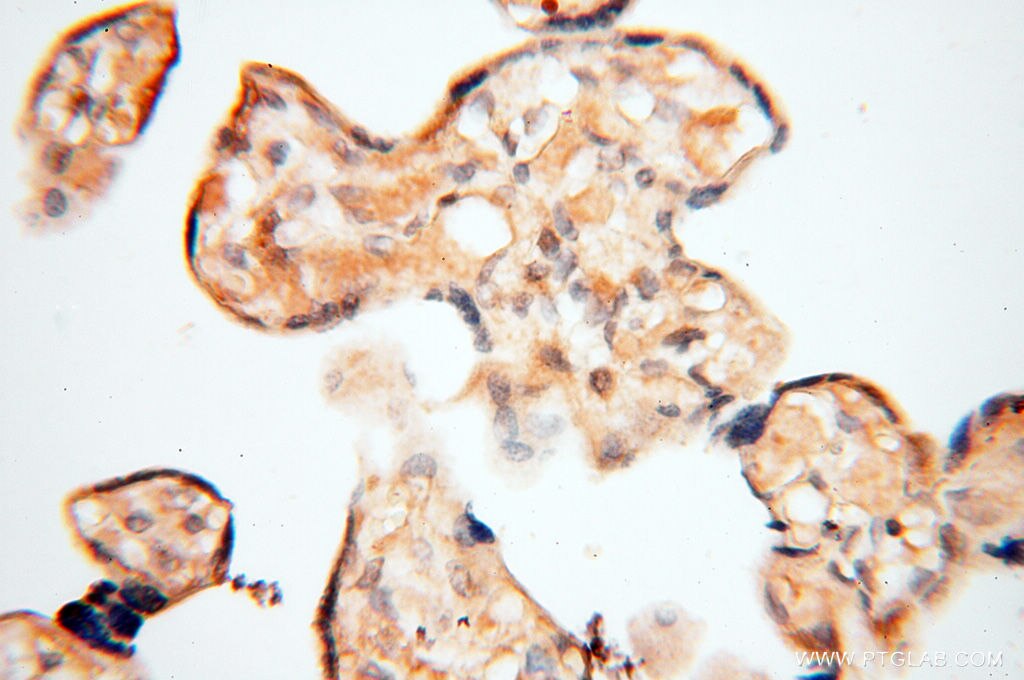Immunohistochemistry (IHC) staining of human placenta tissue using ACAT2 Polyclonal antibody (14755-1-AP)