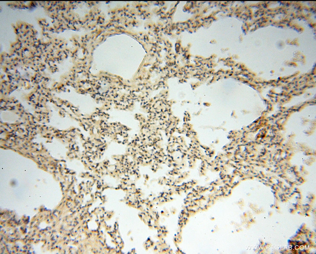 Immunohistochemistry (IHC) staining of human lung tissue using ACAT2 Polyclonal antibody (14755-1-AP)